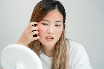 Woman worried about face Dermatology, rosacea dermatitis, allergic steroids, sensitive skin, red...