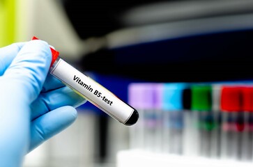 Fototapeta premium Blood sampling tube for vitamin B5 analysis.