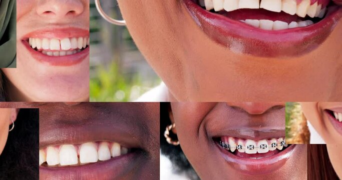 Smile, teeth and lips collage with people in a collection together for diversity, unity or inclusion. Dental, happy or mouth with a montage of natural men and women closeup for hygiene or oral care