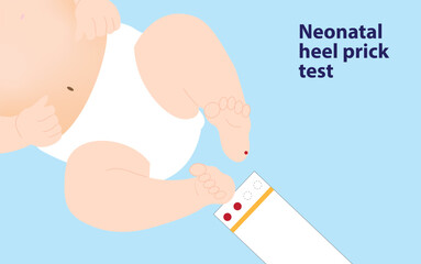 Neonatal heel prick test illustration. Newborn foot with blood and the test paper - obrazy, fototapety, plakaty