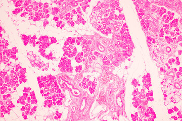 Anatomy and Histological Tonsil and Parotid Human cells under microscope.