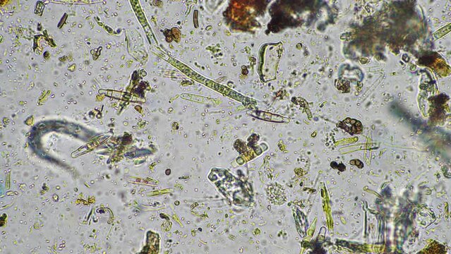 diatom and water microorganisms under the microscope