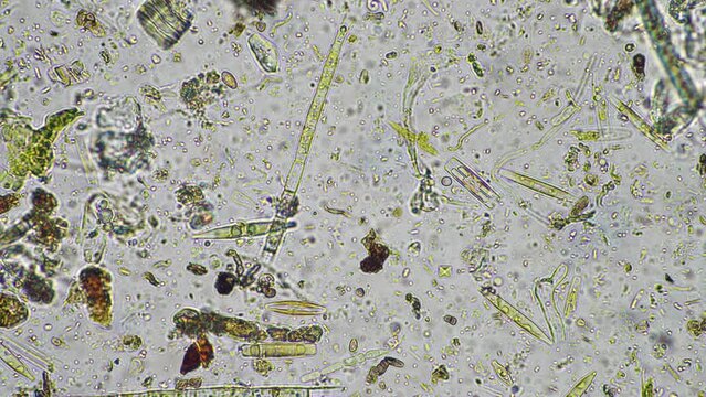 soil microbes organisms in a soil and compost sample, fungus and fungi and under the microscope in regenerative agriculture. in australia.
