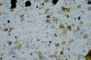 soil microorganisms close up under the microscope. in a soil samlple