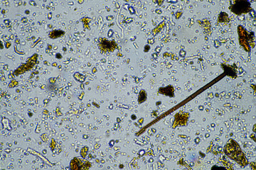 Fungal and fungi hyphae under the microscope in the soil and compost, in a soil biology and...