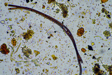 Fungal and fungi hyphae under the microscope in the soil and compost, in a soil biology and microorganism test