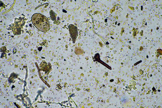 soil microorganisms close up under the microscope. in a soil samlple