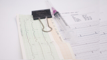heart rhythm ekg note on paper doctors use to analyze heart disease treatment illustration on a white background