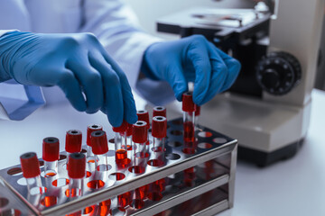 Hands of a doctor or female doctor collecting blood sample tubes from rack with analyzer in lab. Doctor holding blood test tube in research laboratory red blood cells