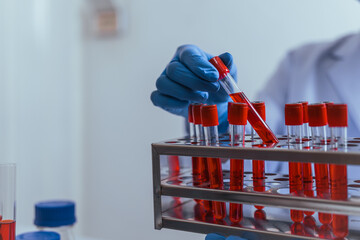 Hands of a doctor or female doctor collecting blood sample tubes from rack with analyzer in lab....