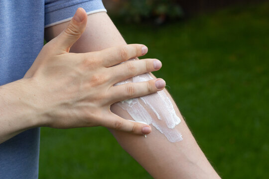 Close-up Of A Man Applying Sunscreen To His Arm.