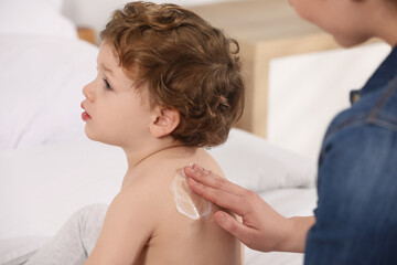 Mother applying ointment onto her son`s back on bed indoors
