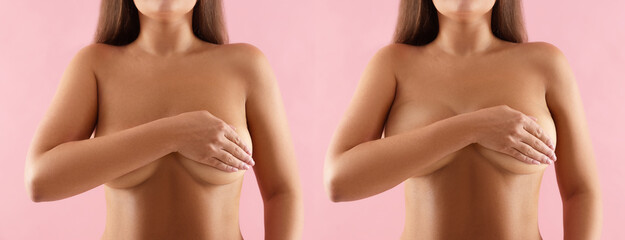 Collage with photos of woman before and after breast-lift surgery on pink background, closeup