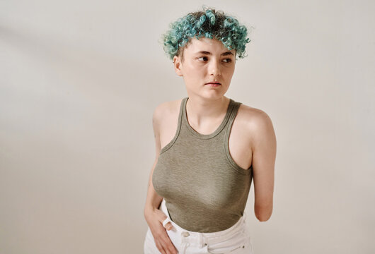 Portrait of young woman with short curly hair and amputee arm isolated on white background