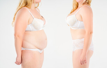Tummy tuck, woman's fat body before and after weight loss and liposuction on light gray background,...