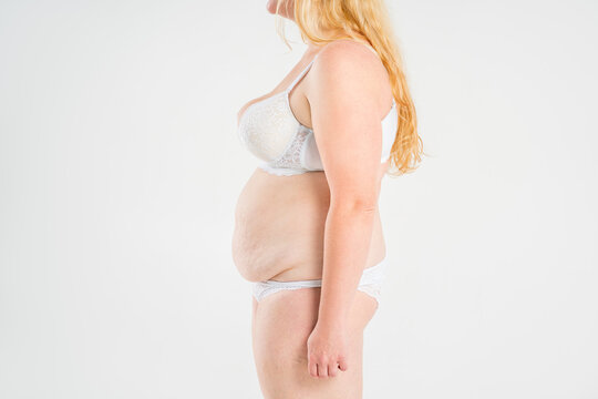 Tummy tuck, flabby skin on a fat belly, plastic surgery and liposuction concept on light gray background
