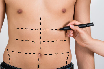 Person Hands Drawing Correction Lines On Abdomen - obrazy, fototapety, plakaty