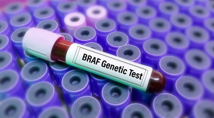 BRAF genetic test to detect the change of tumor that are present in some cancers including...