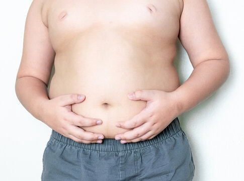 Obese children, overweight, obesity and belly fat