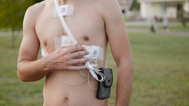 Slender athletic man checks attachment of holter monitor sensors on naked body, close-up. Guy breathes fresh air in park while monitoring work of cardiovascular system, identifying problems, arc shot.