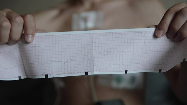Cardiogram graph on paper in hands of man with Holter ECG monitor, close-up. Patient with cardiovascular disease demonstrates results of study and measurement of heart rhythm at home.
