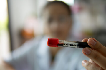 Researcher women working in the lab