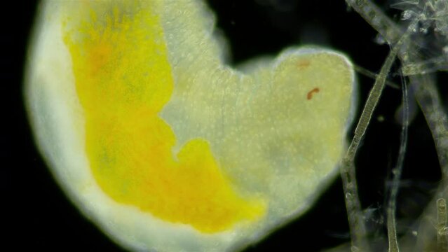 Worm Dinophilus taeniatus under a microscope, family Dinophilidae. Sample found in the White Sea, Jule.