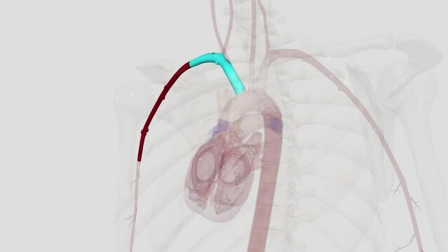 The axillary artery is a large muscular vessel that travels through the axilla