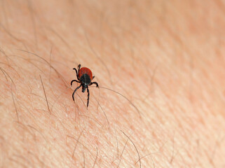 close up of a deer tick on human skin