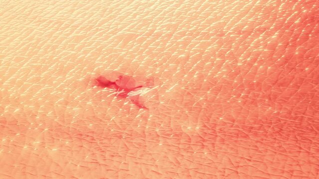 Healing wounds regeneration. A bloody wound disappears, and the skin forms a new texture.
