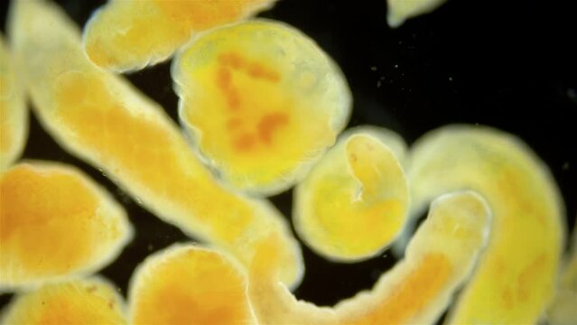 Worms Dinophilus taeniatus under a microscope, family Dinophilidae. Sample found in the White Sea, Jule.