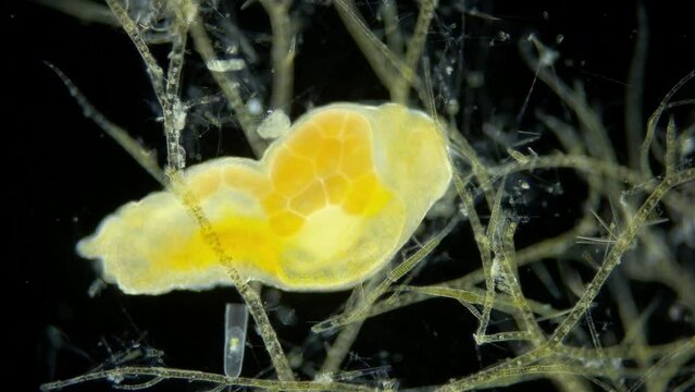 Worm Dinophilus taeniatus under a microscope, family Dinophilidae. Sample found in the White Sea, Jule.
