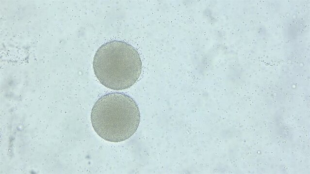 Sperm and ovule sea urchin Strongylocentrotus pallidus under microscope, phylum Echinodermata. White sea