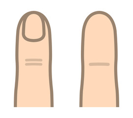 指