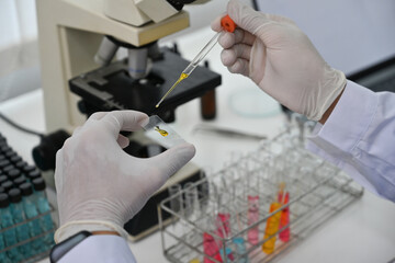Close-up image of the researcher dropping the substance into the microscope slides