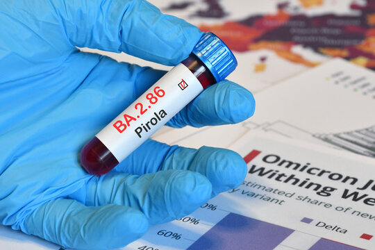 Doctor holds blood test tube for the detection of the BA.2.86 Pirola variant of the Covid-19 virus on papers documents.