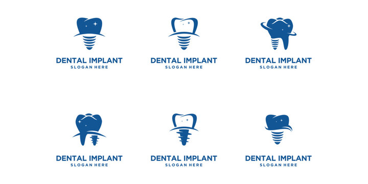 set of vector designs of dental implant logo design concepts, dental health doctor logo, Dental Care logo template