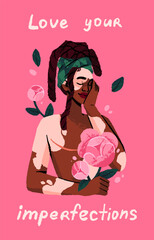 Love your body and accept imperfections concept. Happy woman with vitiligo hold flowers. Beautiful girl with blemish embraces herself. Female person care yourself postcard. Flat vector illustration