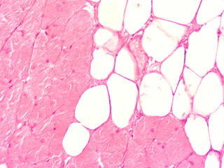 picture of histology human tissue with microscope from laboratory (not Illustration Designation)