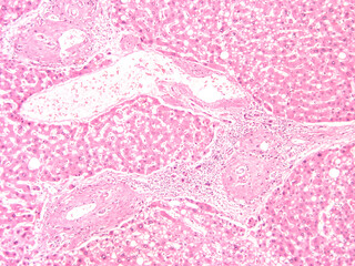 picture of histology human tissue with microscope from laboratory (not Illustration Designation)