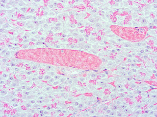 picture of histology human tissue with microscope from laboratory (not Illustration Designation)