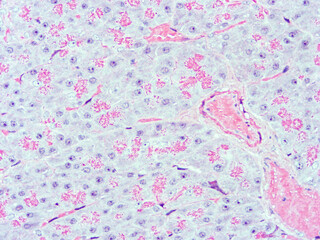 picture of histology human tissue with microscope from laboratory (not Illustration Designation)