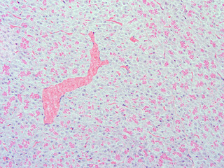picture of histology human tissue with microscope from laboratory (not Illustration Designation)