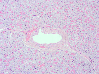 picture of histology human tissue with microscope from laboratory (not Illustration Designation)