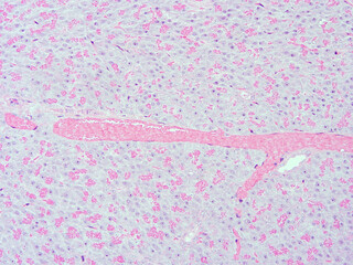 picture of histology human tissue with microscope from laboratory (not Illustration Designation)