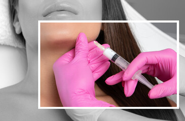 Cosmetologist makes lipolytic injections to burn fat on the chin, cheeks and neck of a woman...