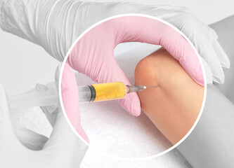 Doctor doing stem cell therapy on a patient's elbow after the injury. Treating knee pain with...