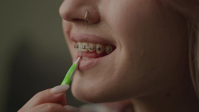 Female Cleaning Dental Braces With Brush Close up. Woman brushing her teeth with braces with special brush.