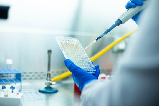 cell culture at the medicine, medical and biology laboratory, cancer science experiment at the safety cabinet