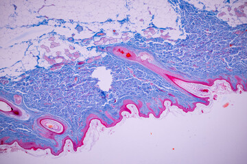 Backgrounds of Characteristics Tissue of Human scalp, Skin human from general body surface and...